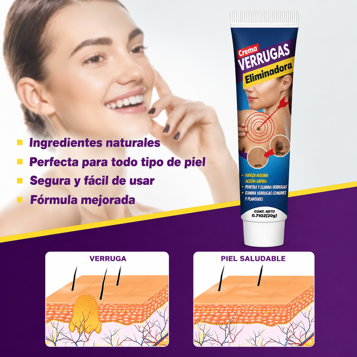 Wart Remover Cream - Eliminador de Verrugas