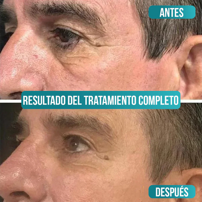 Crema Facial para Ojeras Antiedad Rejuven – Piel Joven con Vitamina C + Ácido Hialurónico